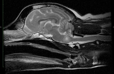 MR-scanning – hvorfor og hvordan? 